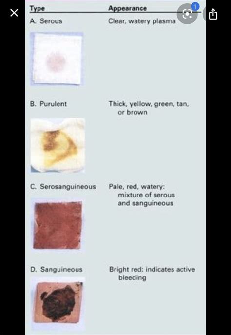 Types of wound drainage | Nursing school survival, Home health nurse ...