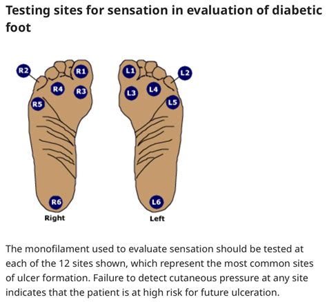 Evidence-Based Physical Exam: Foot Exam in Patients with Diabetes | BROWN MED-PEDS