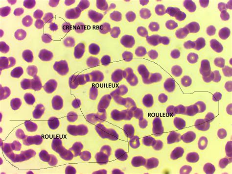 Parasitetesting