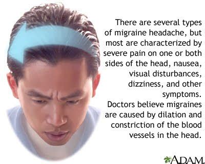 Many Treatments Available To Help Prevent Migraine Unused