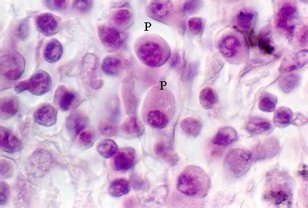 SPECIALIZED CELLS IN CONNECTIVE TISSUE | Microanatomy Web Atlas | Gwen V. Childs, Ph.D.