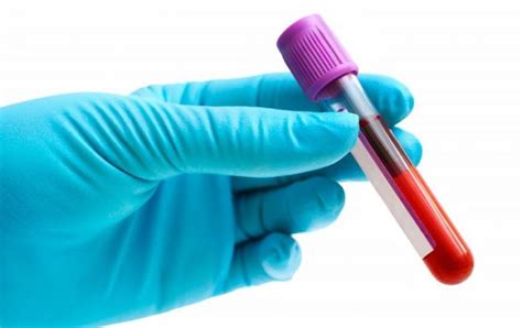 Blood Test at Home - Blood Sample Collection Services in Hyderabad