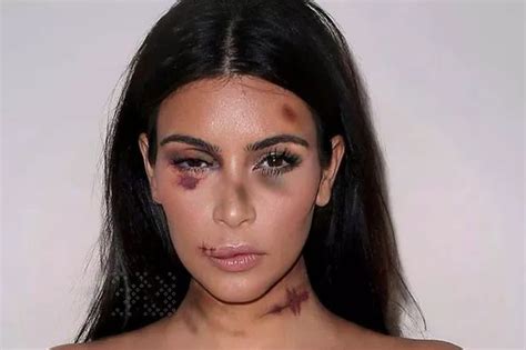 Kim Kardashian ‘bruised and battered’ and left with black eyes in shocking new domestic violence ...