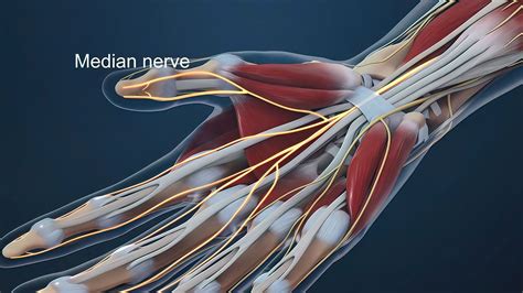 Carpal Tunnel Syndrome Surgery in Gainesville GA & Braselton GA