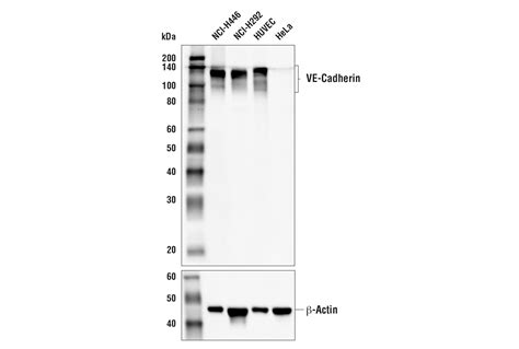 VE-Cadherin (E6N7A) Rabbit mAb (BSA and Azide Free) | Cell Signaling Technology