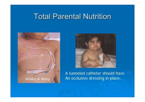 Fluids and Electrolytes in Infants and Children | PPT