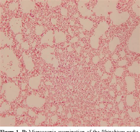 Figure 1 from A case of Rhizobium radiobacter bacteremia in a patient ...