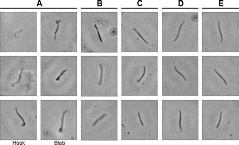 Plasmodium falciparum sporozoite morphology is altered by... | Download Scientific Diagram