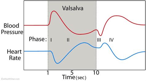 The Valsalva maneuver - Hektoen International