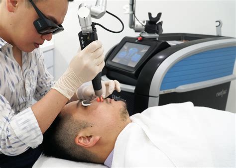 PicoSure Laser for Pigmentation, Acne Scars, Pores and Tattoos – What ...