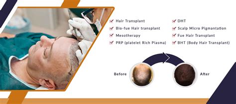 Best Hair Transplant Clinic in Delhi : Dr Mahima Wadhwa