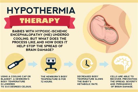 What Is HIE In Babies? Causes, Symptoms And Treatment