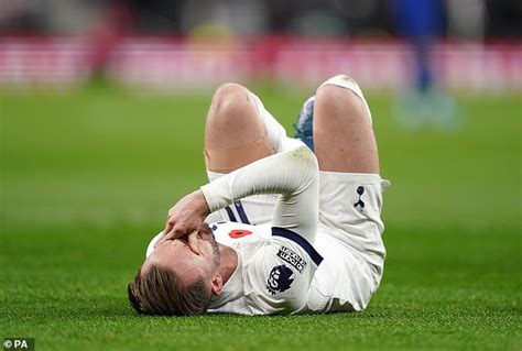 Tottenham fear James Maddison will face a LONG time out with his ankle ...