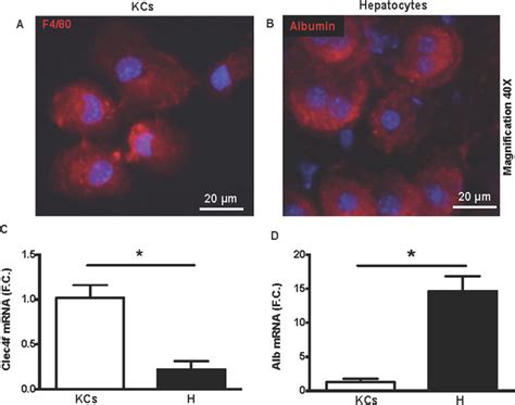 Purity of isolated Kupffer cell (KCs) and hepatocyte fractions. Cells ...