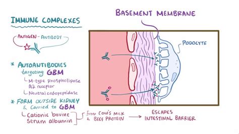 Membranoproliferative Glomerulonephritis