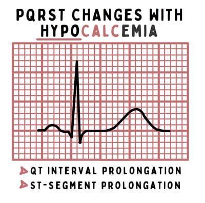 Hypocalcemia Guide for Nurses: Nursing Assessment and Management | Health And Willness