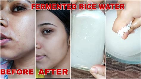 How to Make Fermented Rice Water for Skin - skincaretone.com