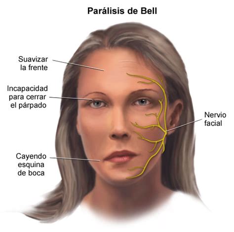 FISIOMÓNICA: Fisioterapia en la Parálisis Facial.