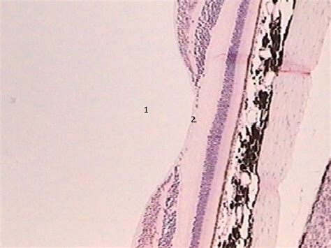 BIO 142 Macula Lutea (Histology) Diagram | Quizlet