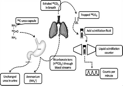 Helicobacter Pylori Tests and Results - Learn Microbiology Online