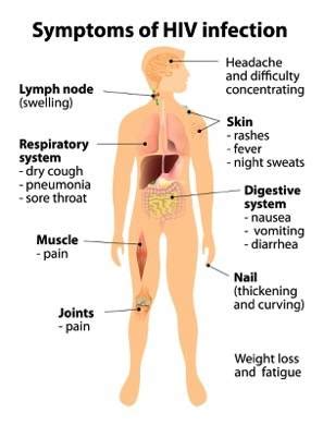 Aids Symptoms In Men