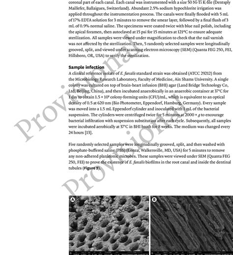 Scanning electron microscope images showing Enterococcus faecalis ...