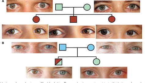 Figure 4 from Genetics of human iris colour and patterns. | Semantic Scholar