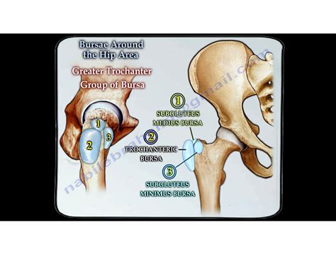 Bursitis around the Hip — OrthopaedicPrinciples.com