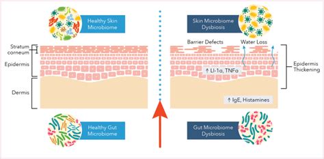 Exploring The Link Between Skin And Gut Health: Insights From Science