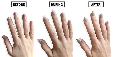 Nail Extensions Before and After - Nail Biting Tricks