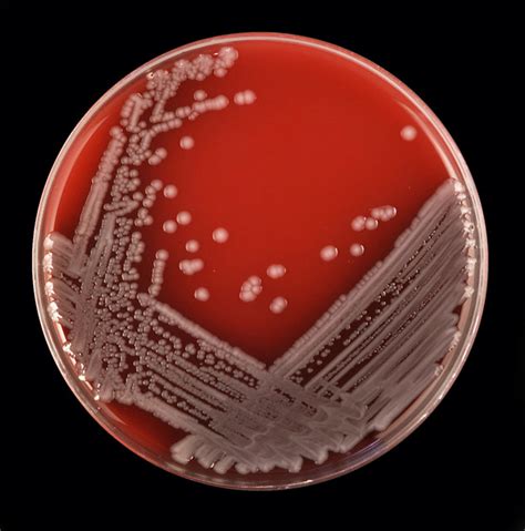 Escherichia coli on Blood Agar - a photo on Flickriver