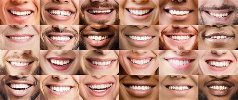 Smile Gallery - Dicesare & Associates- Periodontist - Red Bank, NJ & Manasquan, NJ