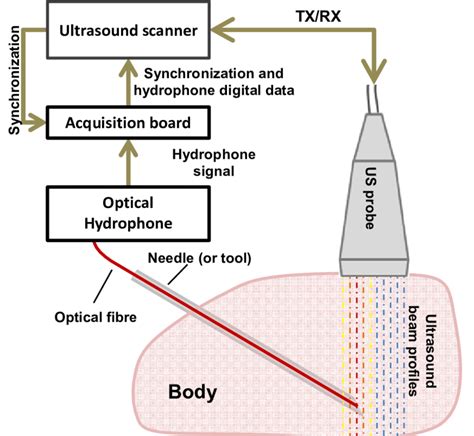 Principle of B-mode UDT collection: a line signal, generated by the... | Download Scientific Diagram