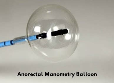 What is Anorectal Manometry and why is it needed? | BHN