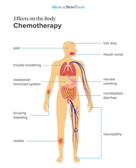 The 10 most common chemotherapy side effects