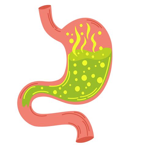 Human stomach. Gastritis and acid reflux, indigestion, vomiting ...