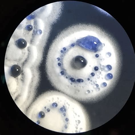 Streptomyces coelicolor colonies releasing actinorhodin : r/microbiology