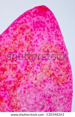 Helminth Parasites Under Microscope View. Stock Photo 530348263 : Shutterstock