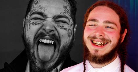 Post Malone’s $1.6 Million Diamond Teeth Transformation – TVovermind