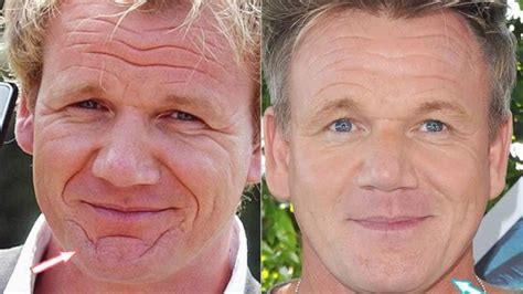 Gordon Ramsay’s Plastic Surgery: Has the 56-Year-Old Chef Received Any ...