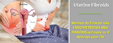 Wide-ranging and Best Treatment for Fibroid with Maximum Success | Fibroid Surgery in India