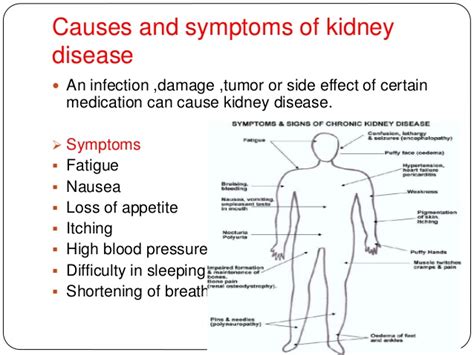 Kidney Failure Causes
