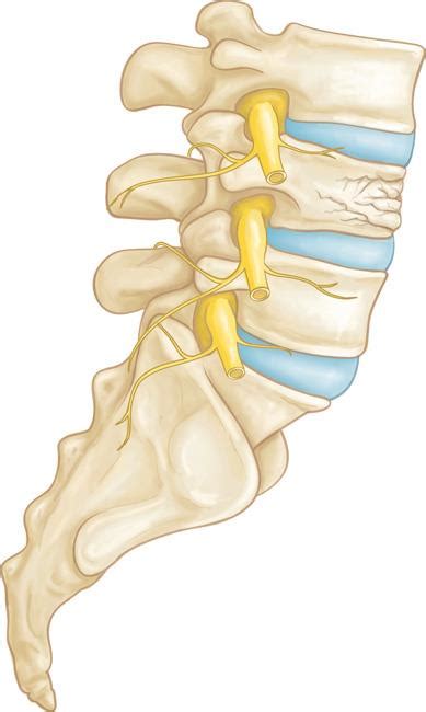 Fractures of the Thoracic and Lumbar Spine - OrthoInfo - AAOS