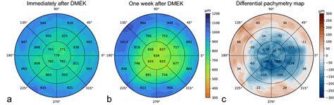 Example of pachymetry maps from one participant in the test set. (a ...