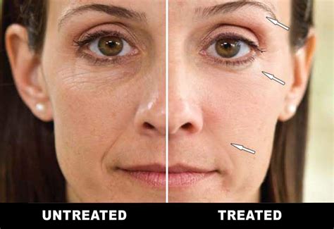 Look Younger with Microcurrent Facial Toning - Guaranteed!