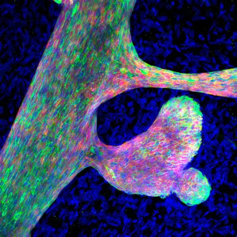 Aberrant mammary branching upo [IMAGE] | EurekAlert! Science News Releases