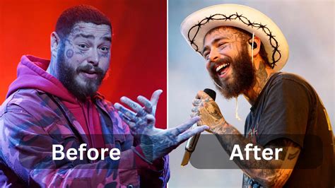 Post Malone weight loss, Surgery, Diet & Workout - Weight Loss