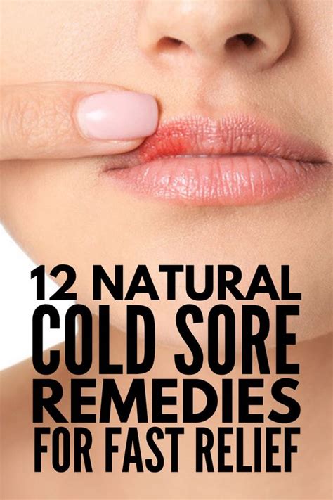 Beautiful Work Tips About How To Stop Cold Sore Swelling - Sumresort14