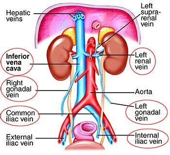 Note: Left gonadal veins drains into Left Renal vein *while* Rt gonadal ...