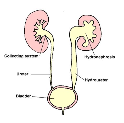 Obstruction – edren.org